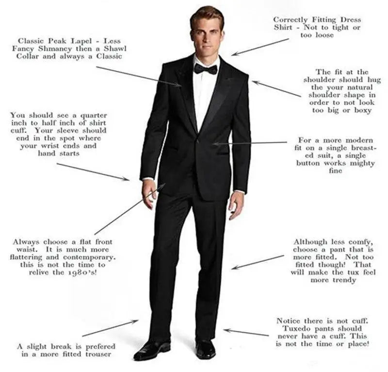 Fashion Yellow Suit for Mens Summer Jacket Shorts Suit 2 Piece Set Wedding Groom Tuxedo Formal Blazer Customized